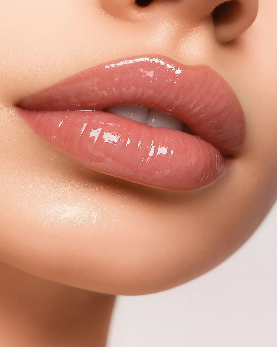 Lip augmentation filler